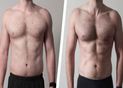 ThermaSculpt Ab Kit by SculptCore